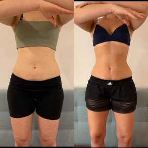 D23124A1-58CF-423C-B6B2-8BB631157370 2